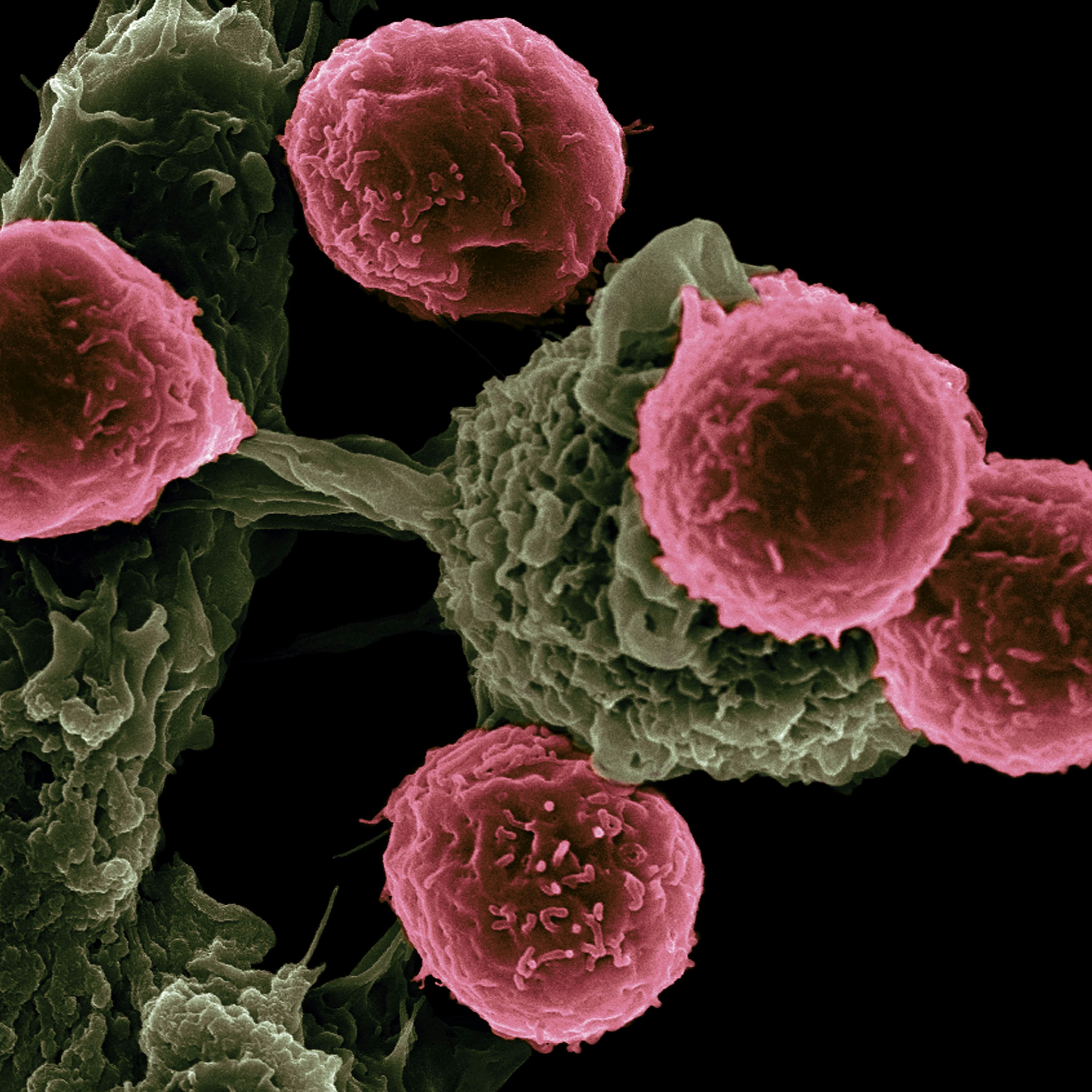 Early HIV Symptoms in Women: Risk Factors and When Evaluation Matters