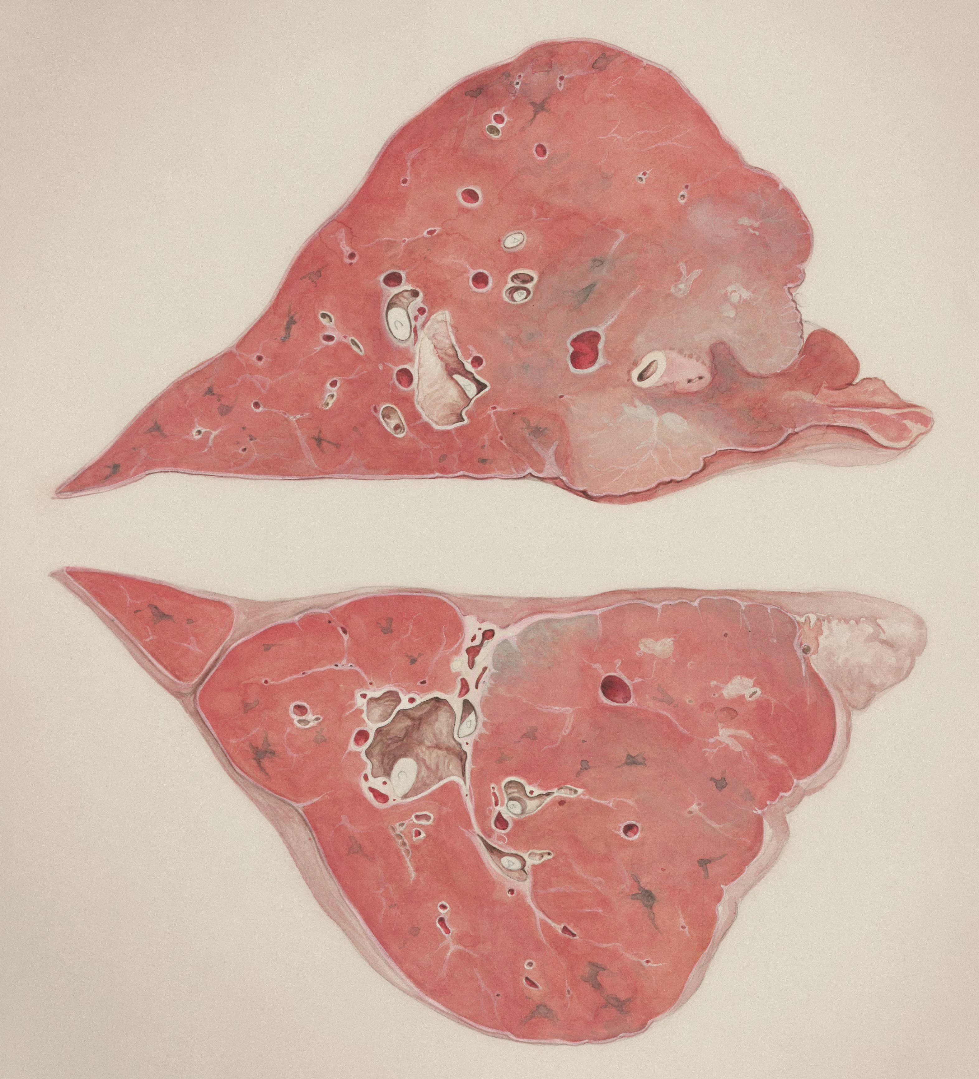 Liver Health and Antioxidants: A Clear Guide to Nutrition, Supplements, and Safety